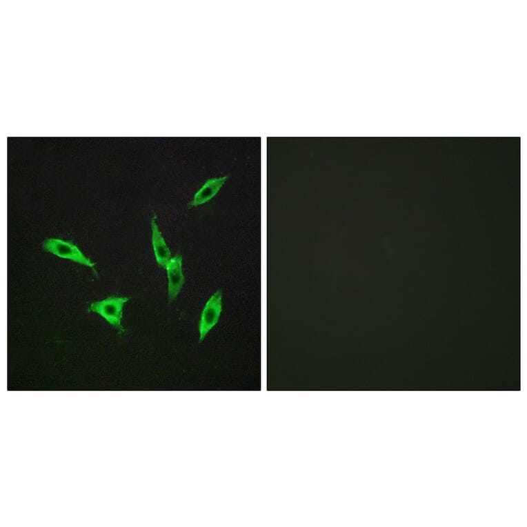 Immunofluorescence - Anti-ADORA2B Antibody (G203) - Antibodies.com