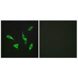 Immunofluorescence - Anti-ADORA2B Antibody (G203) - Antibodies.com