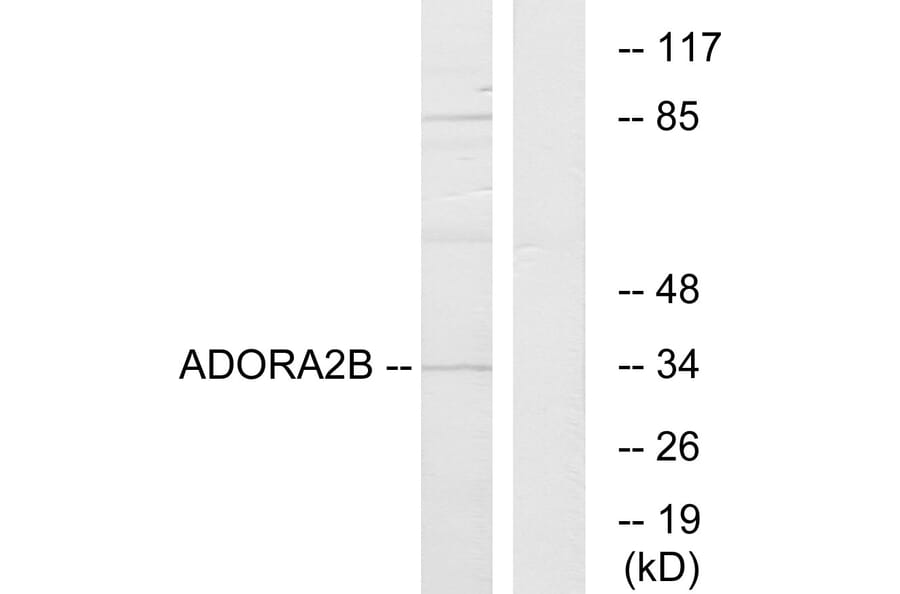 Western Blot - Anti-ADORA2B Antibody (G203) - Antibodies.com