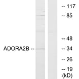 Western Blot - Anti-ADORA2B Antibody (G203) - Antibodies.com