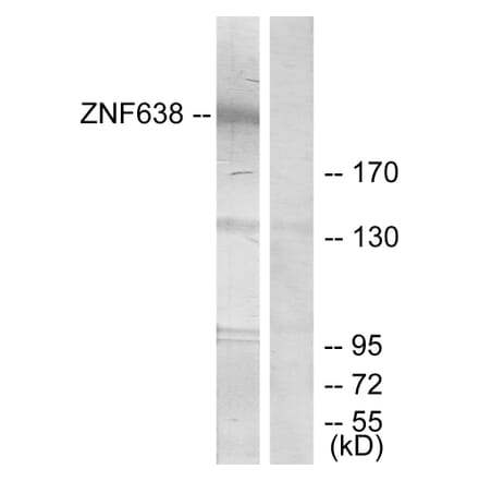 Western Blot - Anti-ZNF638 Antibody (C11052) - Antibodies.com