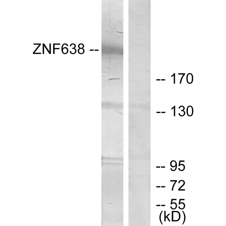 Western Blot - Anti-ZNF638 Antibody (C11052) - Antibodies.com