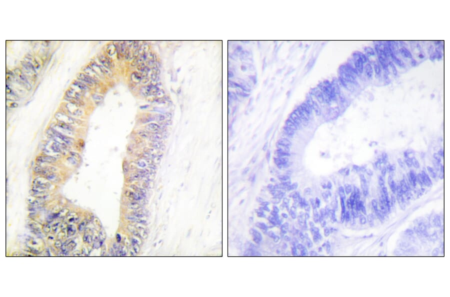 Immunohistochemistry - Anti-ZNF638 Antibody (C11052) - Antibodies.com
