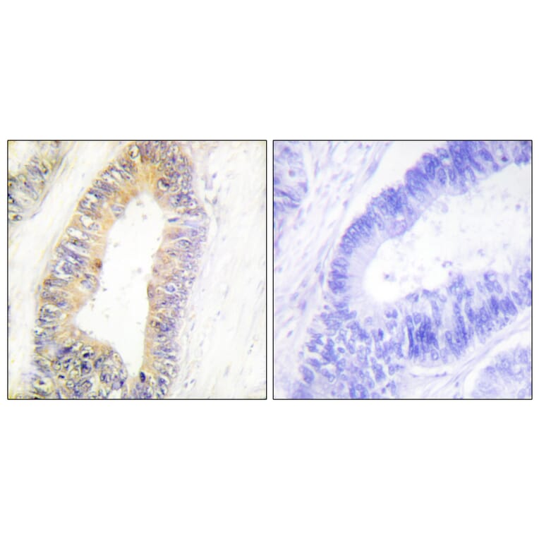 Immunohistochemistry - Anti-ZNF638 Antibody (C11052) - Antibodies.com