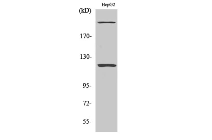Western Blot - Anti-ZNF638 Antibody (C11052) - Antibodies.com