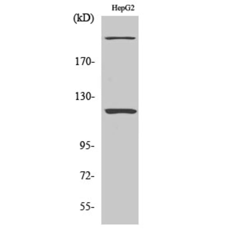 Western Blot - Anti-ZNF638 Antibody (C11052) - Antibodies.com