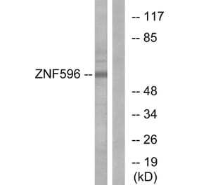 Western Blot - Anti-ZNF596 Antibody (C11388) - Antibodies.com