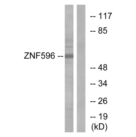 Western Blot - Anti-ZNF596 Antibody (C11388) - Antibodies.com
