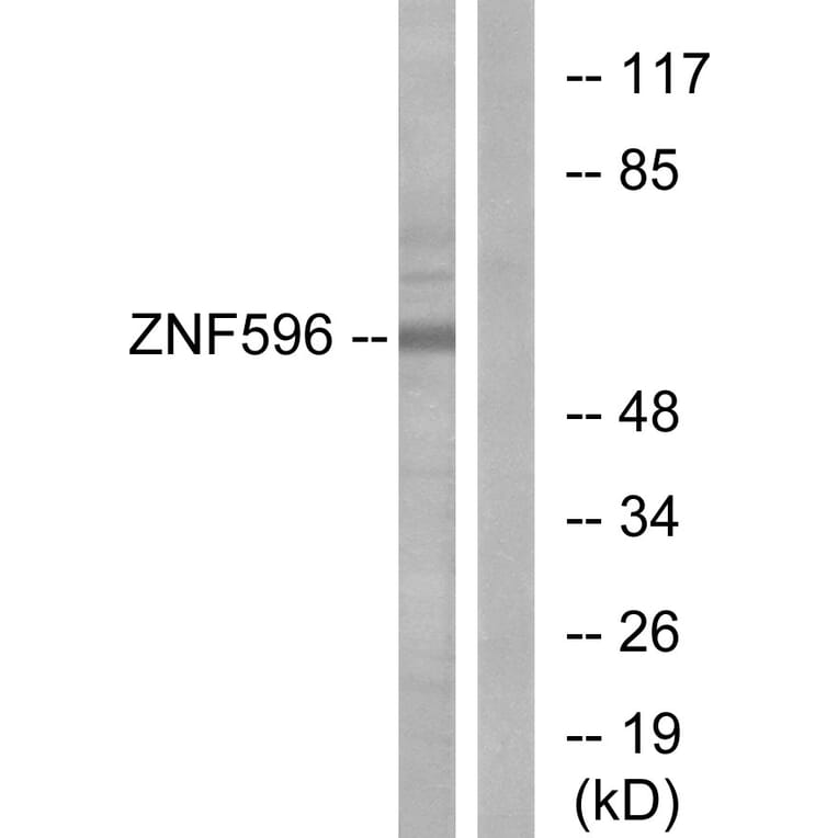 Western Blot - Anti-ZNF596 Antibody (C11388) - Antibodies.com