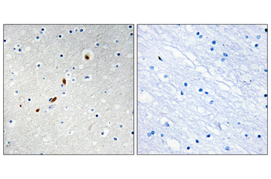 Immunohistochemistry - Anti-ZNF596 Antibody (C11388) - Antibodies.com