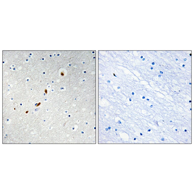 Immunohistochemistry - Anti-ZNF596 Antibody (C11388) - Antibodies.com