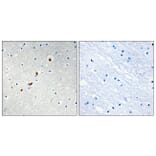 Immunohistochemistry - Anti-ZNF596 Antibody (C11388) - Antibodies.com