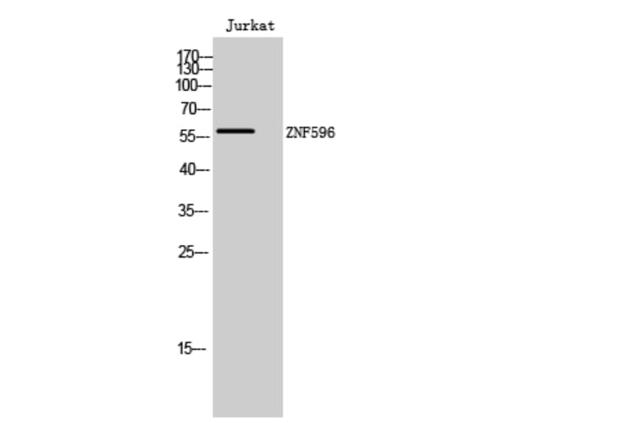 Western Blot - Anti-ZNF596 Antibody (C11388) - Antibodies.com
