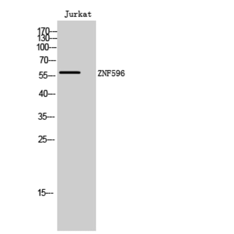 Western Blot - Anti-ZNF596 Antibody (C11388) - Antibodies.com