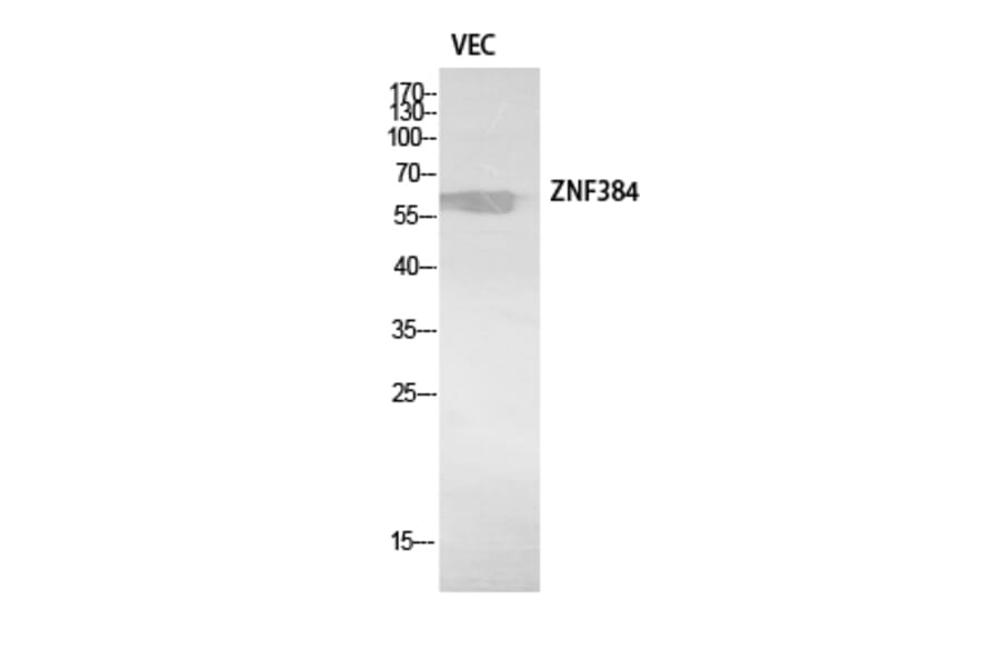 Western Blot - Anti-ZNF384 Antibody (C30974) - Antibodies.com