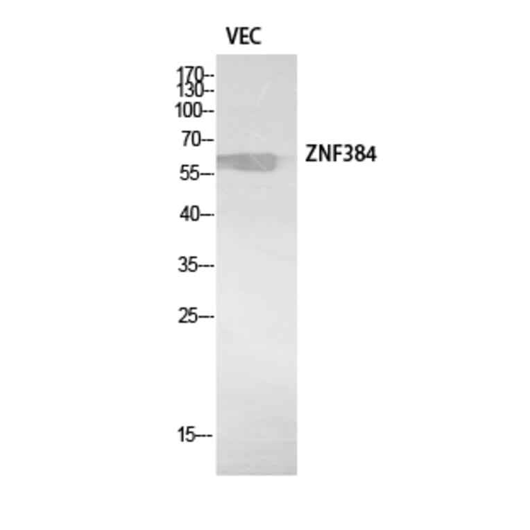 Western Blot - Anti-ZNF384 Antibody (C30974) - Antibodies.com