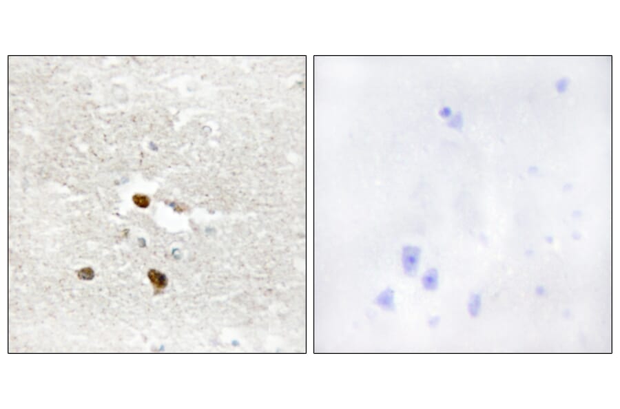 Immunohistochemistry - Anti-ZNF287 Antibody (C11719) - Antibodies.com
