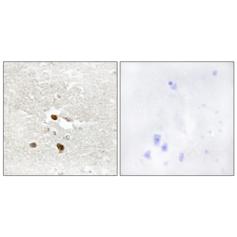 Immunohistochemistry - Anti-ZNF287 Antibody (C11719) - Antibodies.com