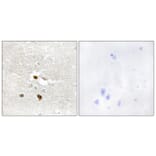 Immunohistochemistry - Anti-ZNF287 Antibody (C11719) - Antibodies.com