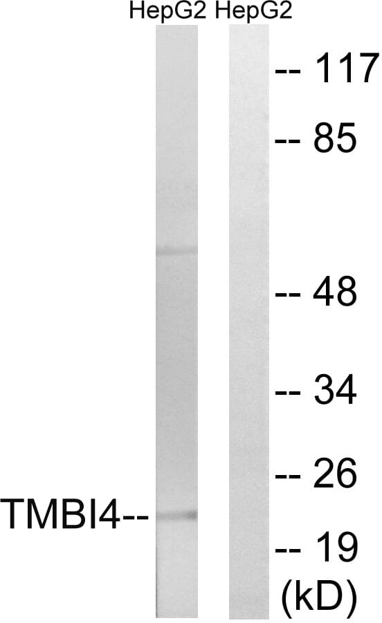 Western blot analysis of lysates from HepG2 cells using Anti-TMBIM4 Antibody. The right hand lane represents a negative control, where the antibody is blocked by the immunising peptide.