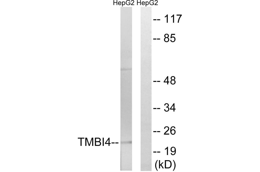 Western Blot - Anti-TMBIM4 Antibody (C19282) - Antibodies.com