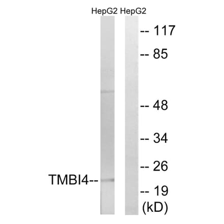 Western Blot - Anti-TMBIM4 Antibody (C19282) - Antibodies.com
