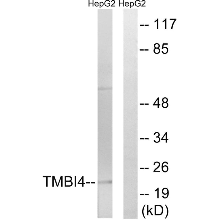 Western Blot - Anti-TMBIM4 Antibody (C19282) - Antibodies.com