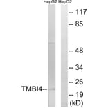 Western Blot - Anti-TMBIM4 Antibody (C19282) - Antibodies.com