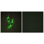 Immunofluorescence - Anti-STEAP4 Antibody (C11207) - Antibodies.com