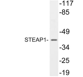 Western Blot - Anti-STEAP1 Antibody (R12-2369) - Antibodies.com
