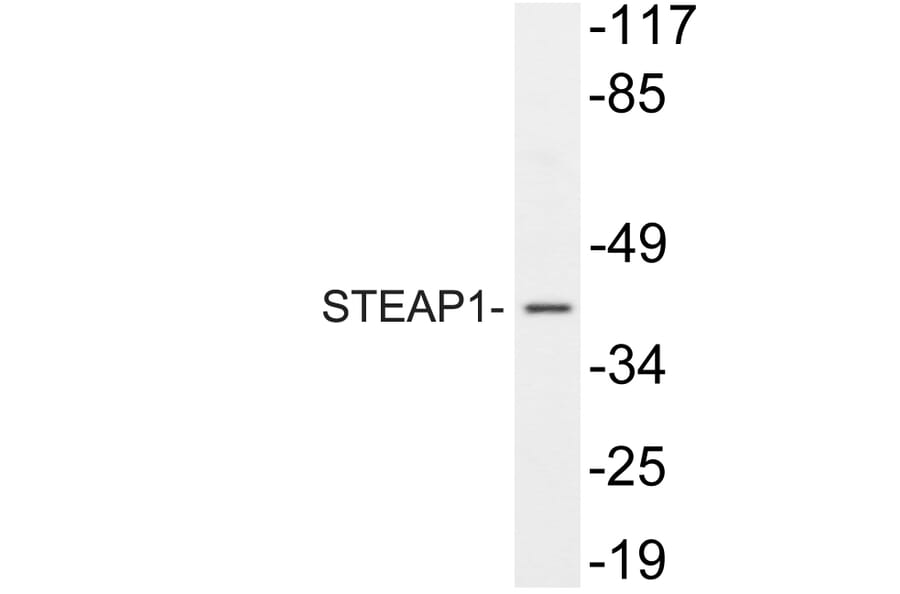 Western Blot - Anti-STEAP1 Antibody (R12-2369) - Antibodies.com