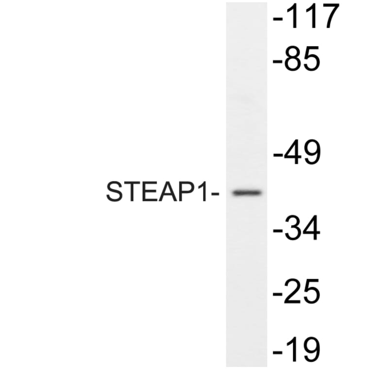 Western Blot - Anti-STEAP1 Antibody (R12-2369) - Antibodies.com