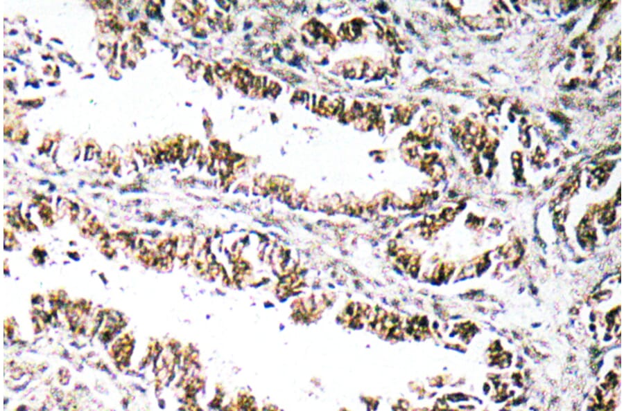Immunohistochemistry - Anti-STEAP1 Antibody (R12-2369) - Antibodies.com