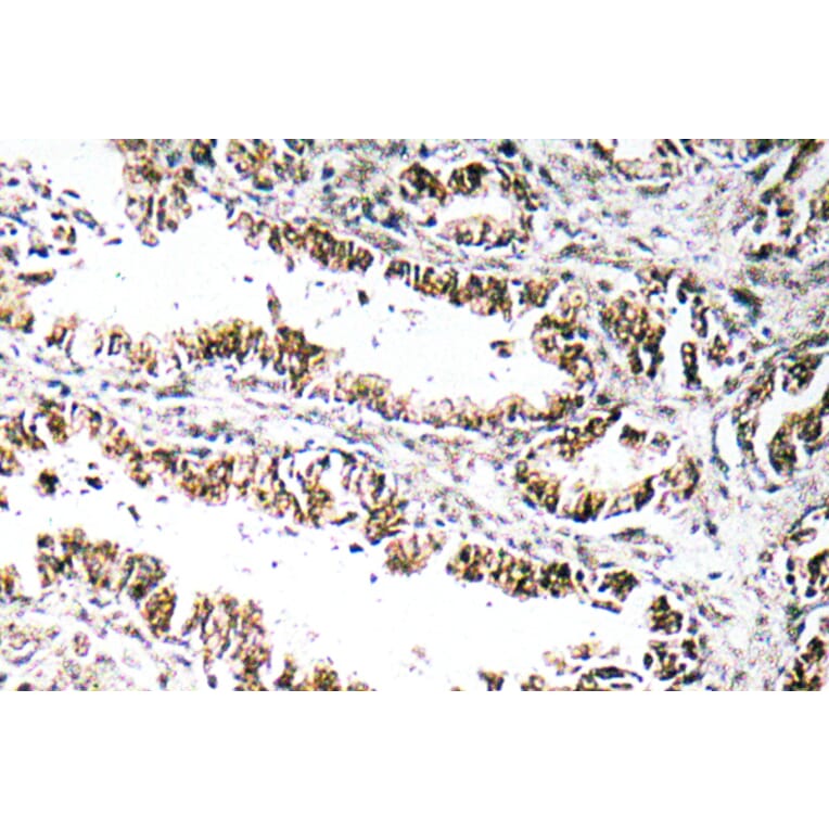 Immunohistochemistry - Anti-STEAP1 Antibody (R12-2369) - Antibodies.com