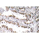 Immunohistochemistry - Anti-STEAP1 Antibody (R12-2369) - Antibodies.com