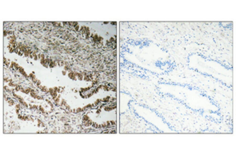Immunohistochemistry - Anti-STEAP1 Antibody (R12-2369) - Antibodies.com