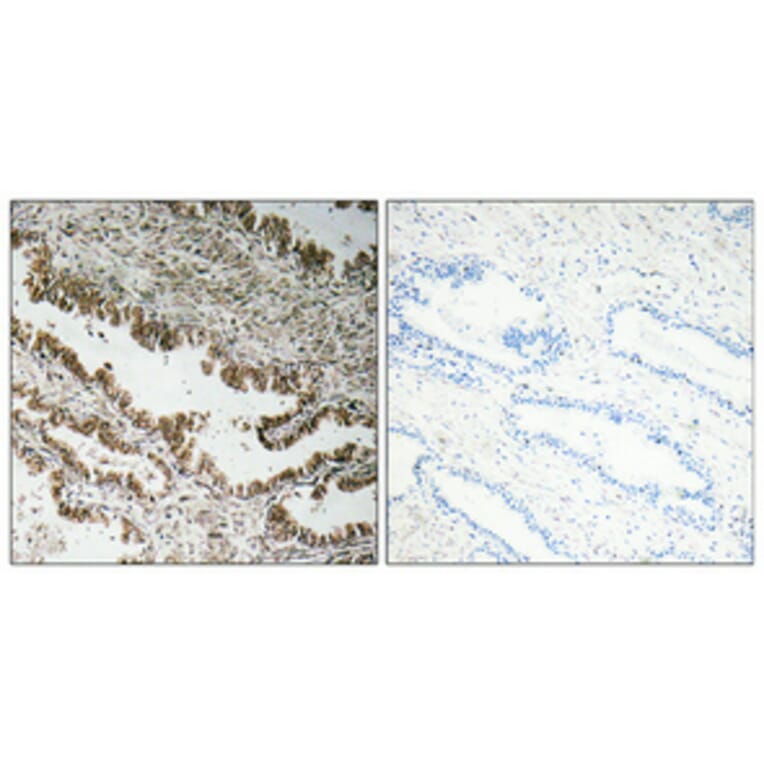 Immunohistochemistry - Anti-STEAP1 Antibody (R12-2369) - Antibodies.com