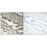 Immunohistochemistry - Anti-STEAP1 Antibody (R12-2369) - Antibodies.com