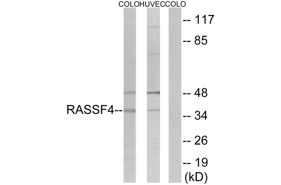Western Blot - Anti-RASSF4 Antibody (C18182) - Antibodies.com