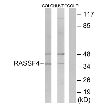 Western Blot - Anti-RASSF4 Antibody (C18182) - Antibodies.com