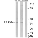 Western Blot - Anti-RASSF4 Antibody (C18182) - Antibodies.com