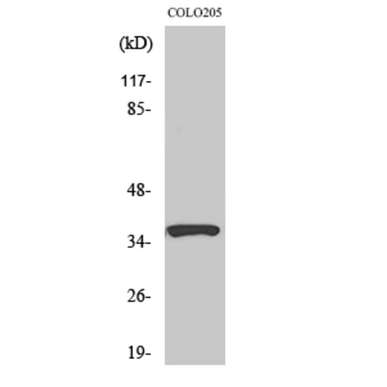 Western Blot - Anti-RASSF4 Antibody (C18182) - Antibodies.com