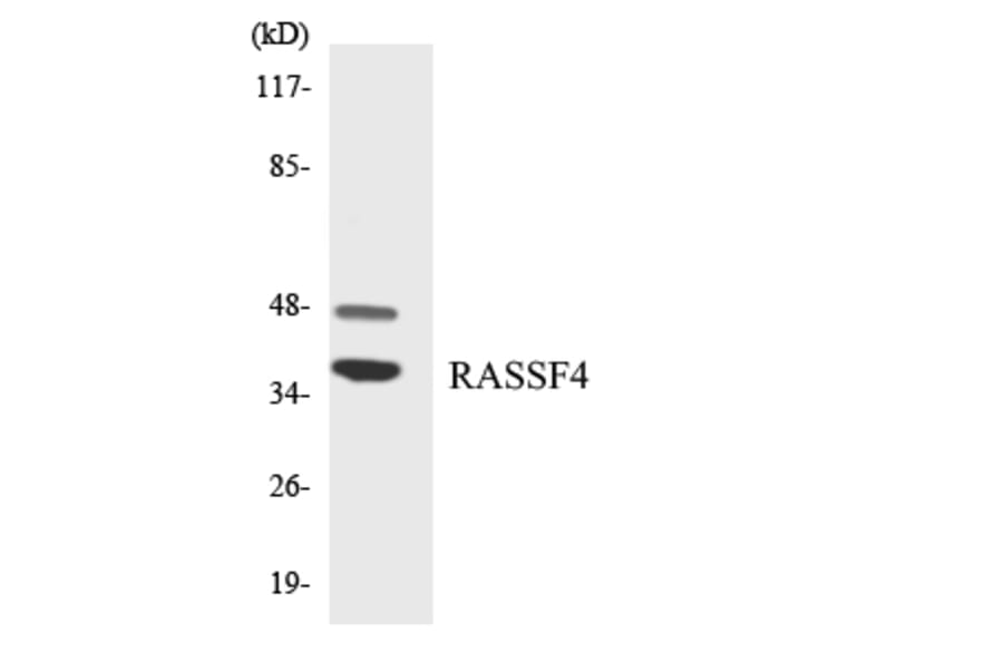 Western Blot - Anti-RASSF4 Antibody (R12-3410) - Antibodies.com