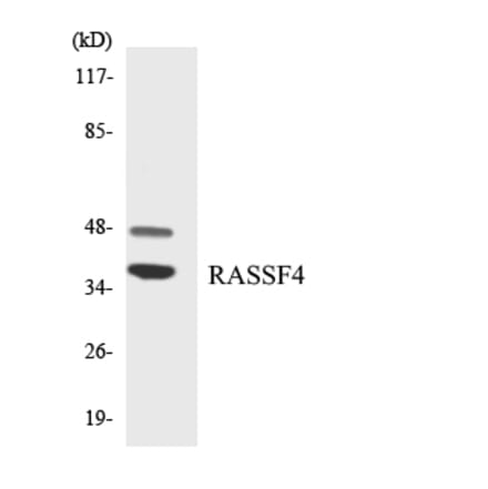 Western Blot - Anti-RASSF4 Antibody (R12-3410) - Antibodies.com