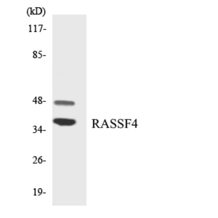 Western Blot - Anti-RASSF4 Antibody (R12-3410) - Antibodies.com