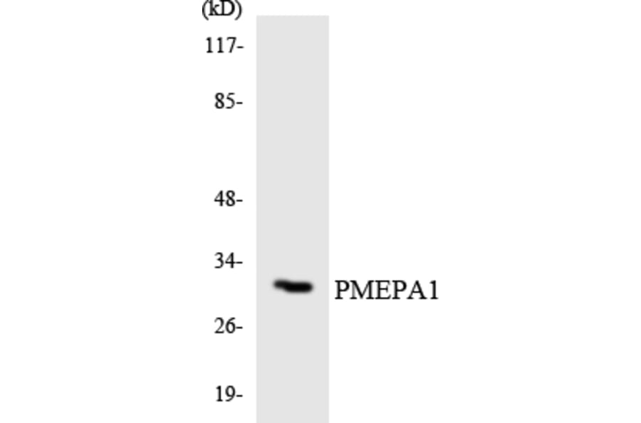 Western Blot - Anti-PMEPA1 Antibody (R12-3340) - Antibodies.com