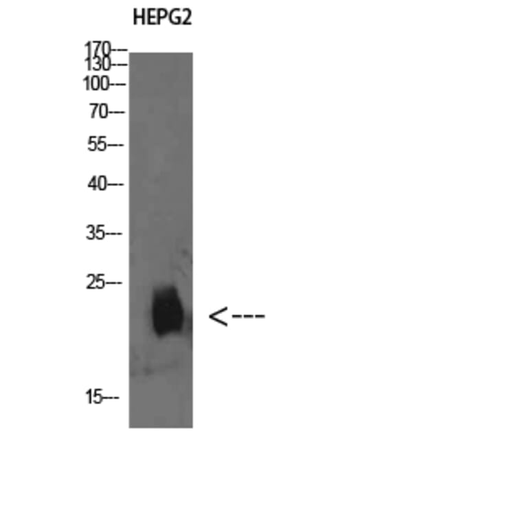 Western Blot - Anti-PLGRKT Antibody (C31023) - Antibodies.com