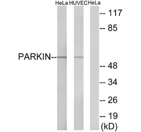 Western Blot - Anti-Parkin Antibody (B0542) - Antibodies.com