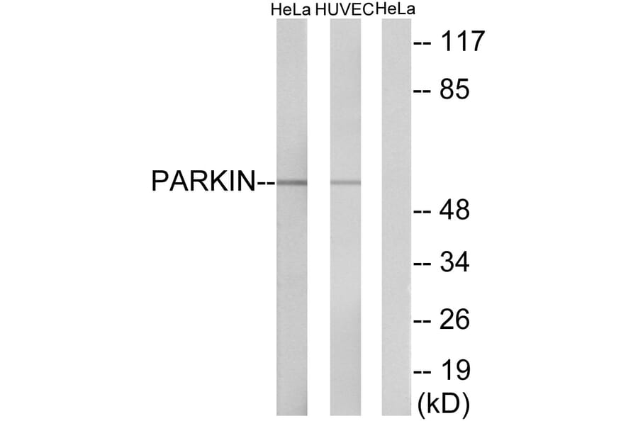Western Blot - Anti-Parkin Antibody (B0542) - Antibodies.com