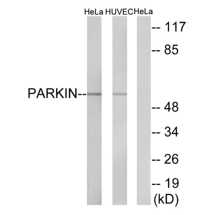 Western Blot - Anti-Parkin Antibody (B0542) - Antibodies.com